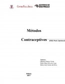 Métodos contraceptivos