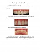 Morfologia dos Incisivos e Caninos