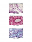 TECIDO EPITELIAL PAVIMENTOSO ESTRATIFICADO QUERATINIZADO