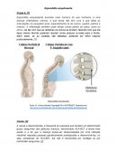 A Espondilite Anquilosante