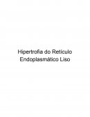 Hipertrofia do Retículo Endoplásmatico Liso
