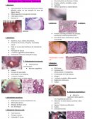 Patologia das Glândulas Salivares