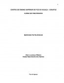 CENTRO DE ENSINO SUPERIOR DE FOZ DO IGUAÇU – CESUFOZ CURSO DE FISIOTERAPIA