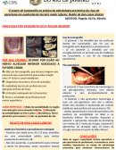 O Exame de Tomografia na Prática da Odontologia Preventiva do Risco de Parestesia em exodontia de terceiro molar inferior: Relato de dois casos clínicos