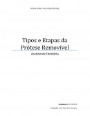 Tipos e Etapas da Prótese Removível