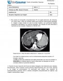 Tomografia Centro Universitário Cesumar Pró Reitoria