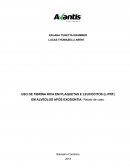 USO DE FIBRINA RICA EM PLAQUETAS E LEUCÓCITOS (L-PRF) EM ALVÉOLOS APÓS EXODONTIA: Relato de caso